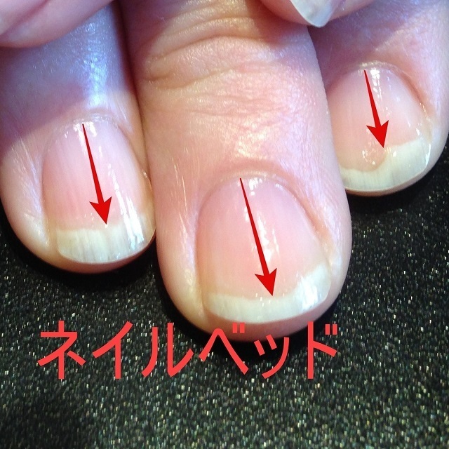 ハイポニキウムとは 特徴や注意点をわかりやすく解説します