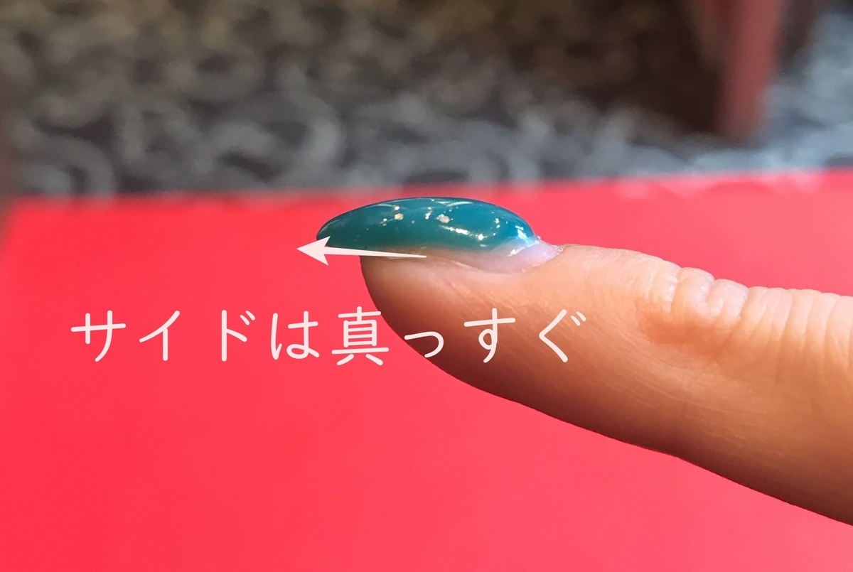 深爪を自分で直すこと出来る 爪をキレイに矯正する方法