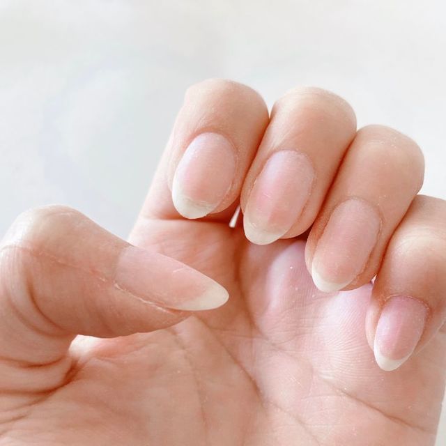 爪の白い部分が増える５つの原因と対策をわかりやすく解説します