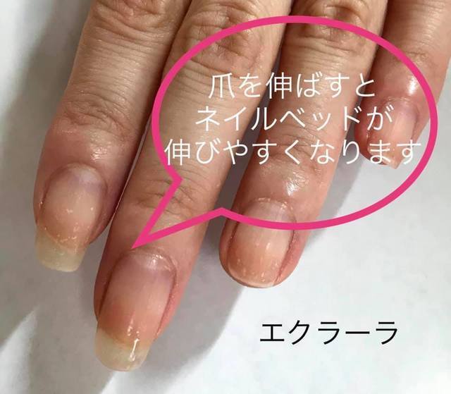 ネイルベッドを育てるには爪を短くしすぎないことが大切