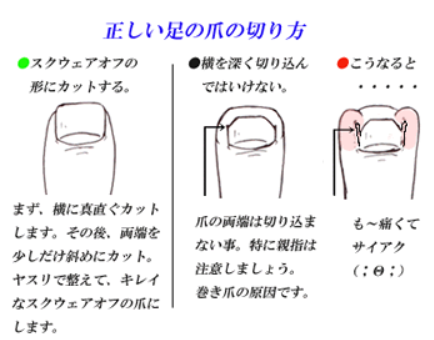 足の爪ケア方法 セルフで出来る簡単お手入れ方法３ステップ